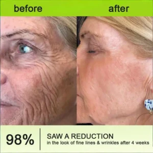 🧠👨‍⚕️Made and shipped from the USA Botin & Vita-A Retinol Shot Wrinkle-Lift Tightening cream - Last Day Promotion 50% OFF - Image 3