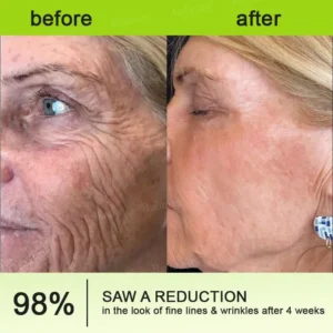 Made and shipped from the USA 🎉 Botox & Vita-A Retinol Shot Wrinkle-Lift Tightening Cream - Image 13