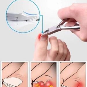 Medical-Grade Nail Clipper - Image 7