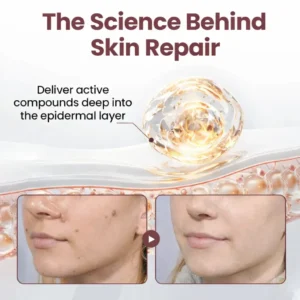 KeraErase Dual-Action Renewal Cream - Image 4