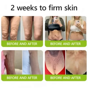 Botox & Retinol Shot - Image 5