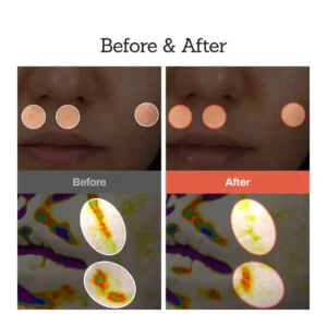 Retinal Skin Booster Serum - Image 6