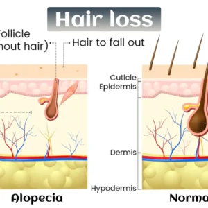 Biotin-Infused Hair & Beard Regrowth Atomizer -🔥7-Day Results - Image 8