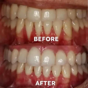 Fluoride-Free Nano Hydroxyapatite Tooth Powder - Image 3