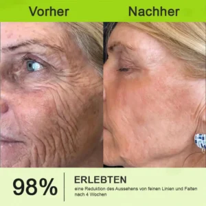 Now regain youthful skin. 💫👨‍⚕️ NESLEMY ™ Wrinkle relaxer & Vita-A Retinol Shot Wrinkle Lift Firming Cream - Image 12