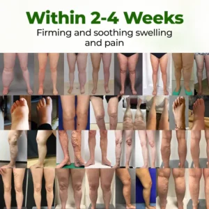 Advanced Leg Circulation Cream - Image 2