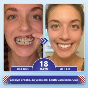 𝑇𝑖𝑑𝑒𝑔𝑙𝑢𝑠𝑖𝑏 𝑇𝑜𝑜𝑡ℎ & 𝐺𝑢𝑚 𝑅𝑒𝑝𝑎𝑖𝑟 𝐹𝑎𝑠𝑡-𝐷𝑖𝑠𝑠𝑜𝑙𝑣𝑖𝑛𝑔 𝑂𝑟𝑎𝑙 𝑆𝑡𝑟𝑖𝑝𝑠 - Image 10