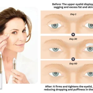 Eyelid Tightening Cream - Image 2