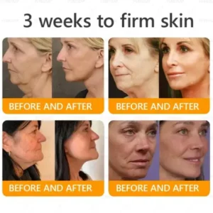 Bee Venom Wrinkle-Firming Multi-purpose Cream - Image 4