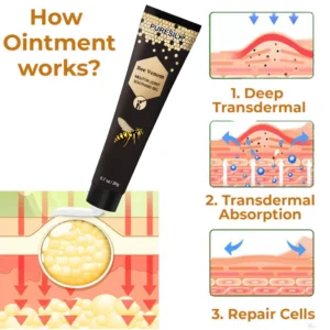 Lipoma Treatment Ointment - Image 2