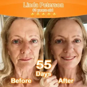 Stem Cell Extract EGF and Copper Peptide Revitalizing Essence Cream (deeply activates the skins internal regeneration, making the skin firmer and smoother) - Image 8