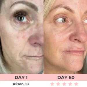 QIAWI 7-in-1 LED Facial Sculptor - Image 11
