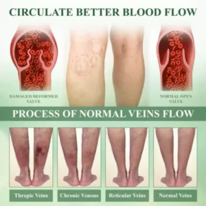 Leg Therapy Edema Cream - Image 6