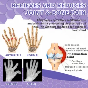 Snake Venom Joint Therapy Pain Relief Gel - Image 3