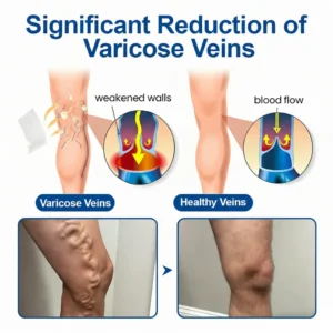VeinTarget Microneedle Patch - Instant Relief, Long-Term Results - Image 4