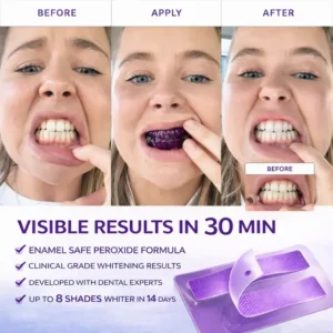Purple Teeth Whitening Strips - Image 9