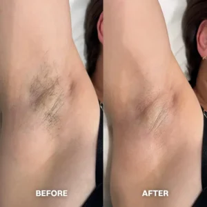 Hair Removal Cream for All Women & Men - Image 12