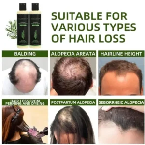 Rosemary Hydrolyzed Keratin Shampoo - Image 3