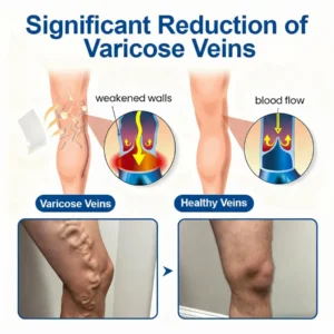VeinEase Microneedle Care Patch - Image 4