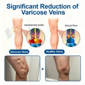 VeinEase Microneedle Care PatchInstant Relief, Long-Term Results - Image 4