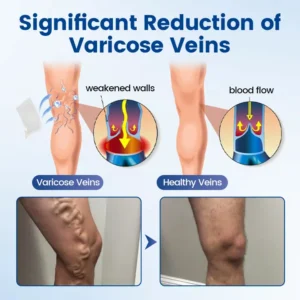 Vein Ease Microneedle Therapy Patch - Image 5