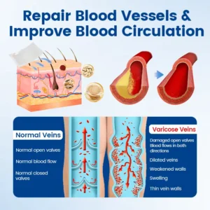 Vein Ease Microneedle Therapy Patch🔥 - Image 6