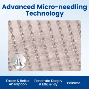 Vein Ease Microneedle Therapy Patch - Fast ⚡Effective 💪 and Non-Invasive 🚫 Treatment for Varicose Veins & Leg Swelling 👣 - Image 2