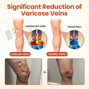 VeinTarget Microneedle Patch - Image 3