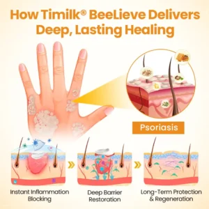 BeeLieve Psoriasis Skin Care - Image 4