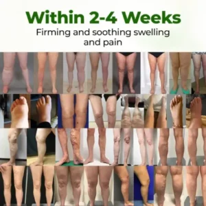 Professional Leg Circulation Cream - Image 2