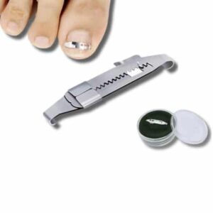 Toenails Correction Stainless Steel Clip Buckle - Image 4
