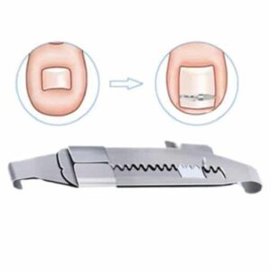 Toenails Correction Stainless Steel Clip Buckle - Image 3