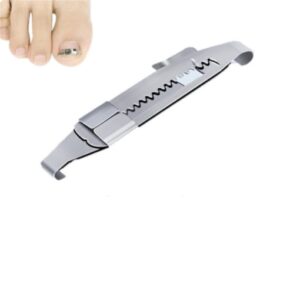 Toenails Correction Stainless Steel Clip Buckle - Image 2