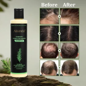 🔥**¡ÚLTIMO DÍA: 50% DE DESCUENTO!** - 🎅Champú orgánico de romero para el crecimiento del cabello - Image 8