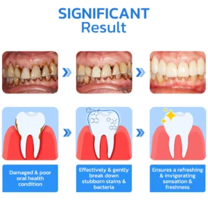 Gum Repair Strips - Image 3
