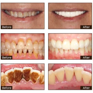 Niacinamide Whitening Toothpaste - Image 4