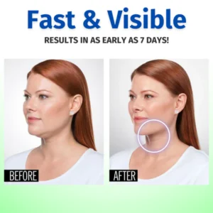 Lymphatic Drainage Slimming Earrings - Image 4