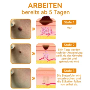 Bienengift Waren & Muttermalenfernung Creme - Image 11