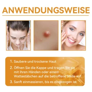 Bienengift Waren & Muttermalenfernung Creme - Image 14