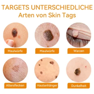 Bienengift Waren & Muttermalenfernung Creme - Image 7