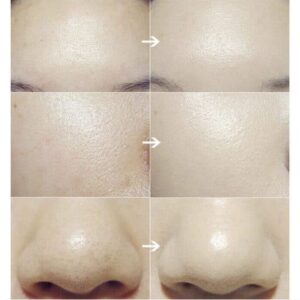 Facial Cleansing Brush - Image 4