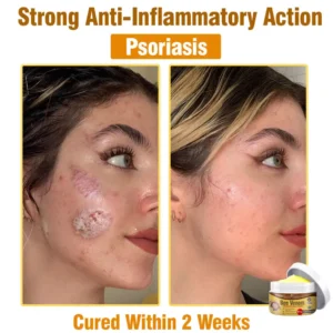 Bee Venom Comprehensive Skin Treatment Cream - Image 3
