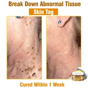 Bee Venom Comprehensive Skin Treatment Cream - Image 5
