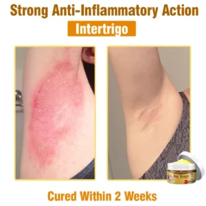 Bee Venom Comprehensive Skin Treatment Cream - Image 8