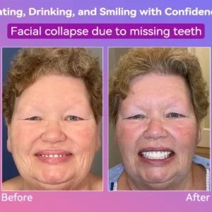 𝐍𝐞𝐱𝐭-𝐆𝐞𝐧 𝐂𝐨𝐦𝐟𝐨𝐫𝐭 𝐃𝐞𝐧𝐭𝐮𝐫𝐞 - Image 4