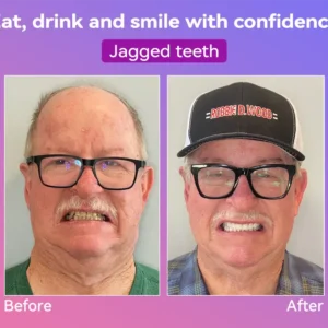 𝐍𝐞𝐱𝐭-𝐆𝐞𝐧 𝐂𝐨𝐦𝐟𝐨𝐫𝐭 𝐃𝐞𝐧𝐭𝐮𝐫𝐞 - Image 5