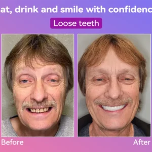 𝐍𝐞𝐱𝐭-𝐆𝐞𝐧 𝐂𝐨𝐦𝐟𝐨𝐫𝐭 𝐃𝐞𝐧𝐭𝐮𝐫𝐞 - Image 7