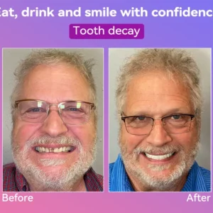 𝐍𝐞𝐱𝐭-𝐆𝐞𝐧 𝐂𝐨𝐦𝐟𝐨𝐫𝐭 𝐃𝐞𝐧𝐭𝐮𝐫𝐞 - Image 8
