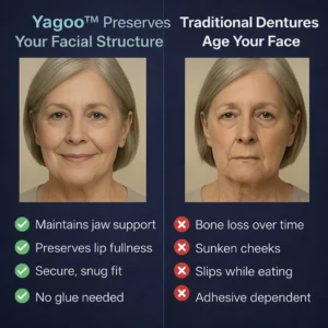 Newly upgraded second-generation complete dentures - Image 10