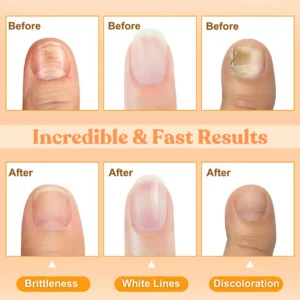 Bee Venom Nail Repair Treatment Spray - Image 4